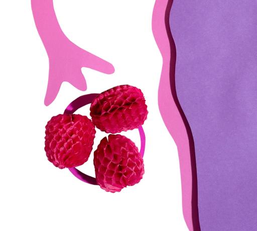 Polikistik Over Sendromu (PCOS) ve adet düzensizliğini gösteren tıbbi görsel